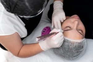 Microneedling FAQs – How Long After Microneedling Can I Wear Makeup?